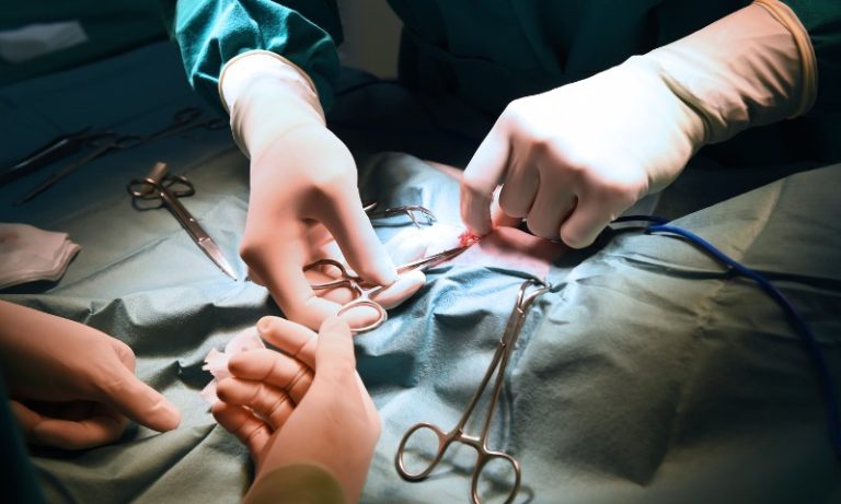 Mulher descobre pinça esquecida em cirurgia ao ser barrada em detector de metais