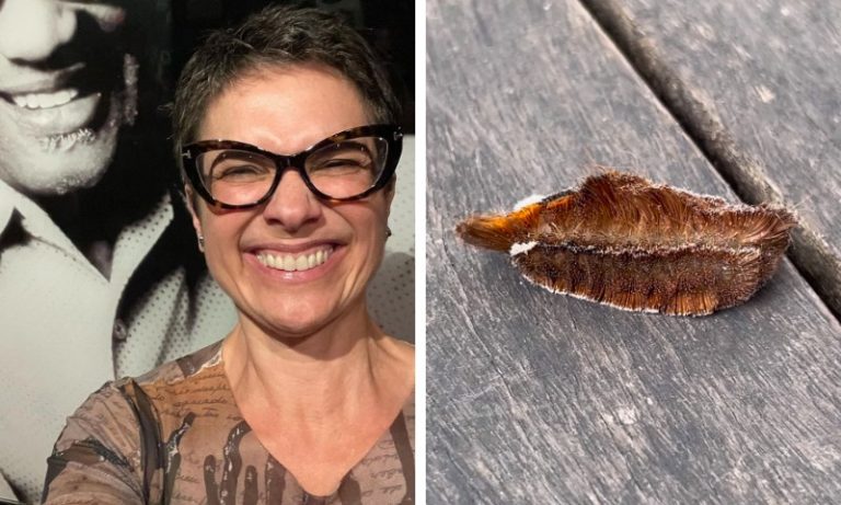 Sandra Annenberg publica foto no hospital após pisar em lagarta: ‘Dor insuportável’