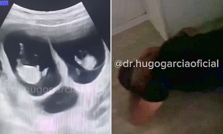 Pai desmaia ao descobrir que esposa está grávida de trigêmeos