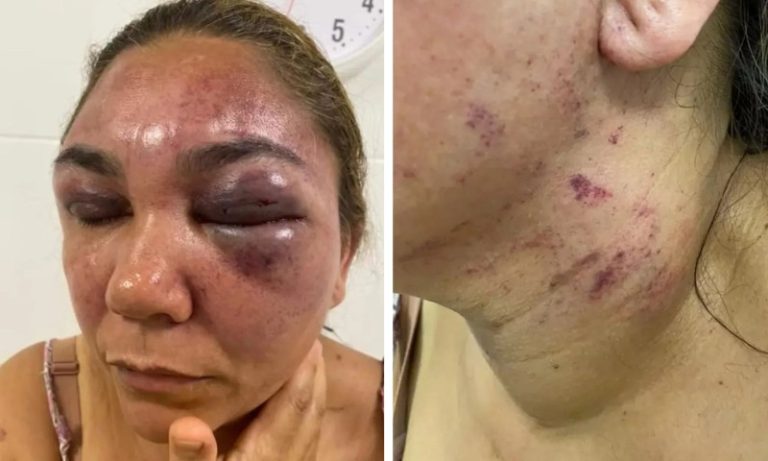 Vítima de violência doméstica no ES escreve carta aberta: “Não estamos sozinhas”