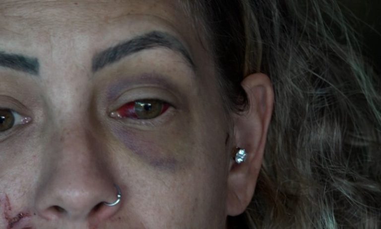 “Chama a polícia!”: dona de hostel apelou por socorro durante agressão