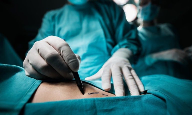 “Sonho da cirurgia estética virou pesadelo”, diz cabeleireira