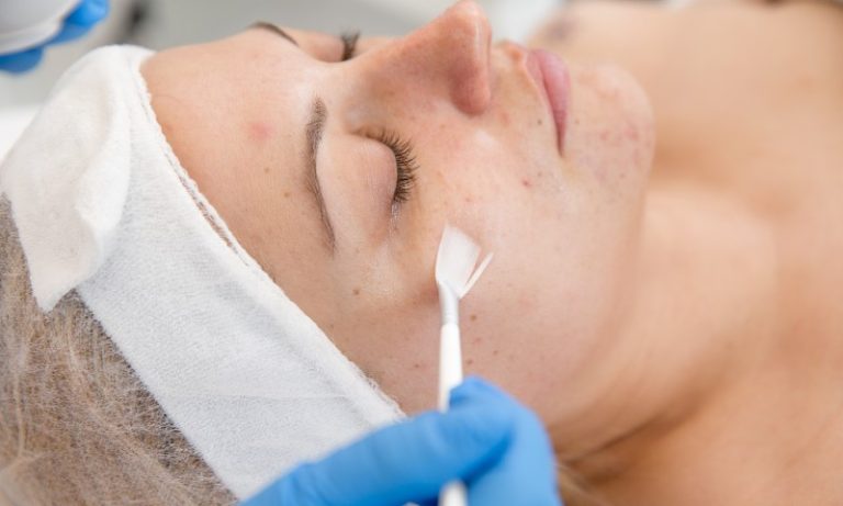 O que é peeling de fenol? Buscas pelo procedimento disparam no Google