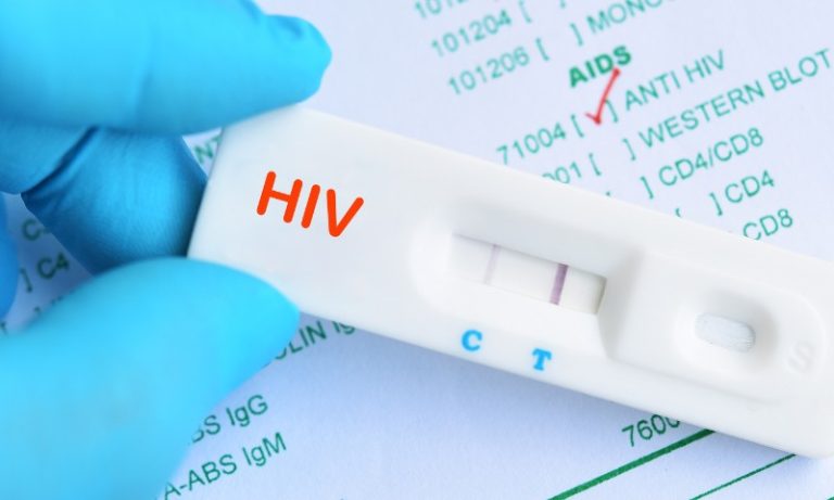Farmácias poderão realizar testes rápidos de HIV e sífilis