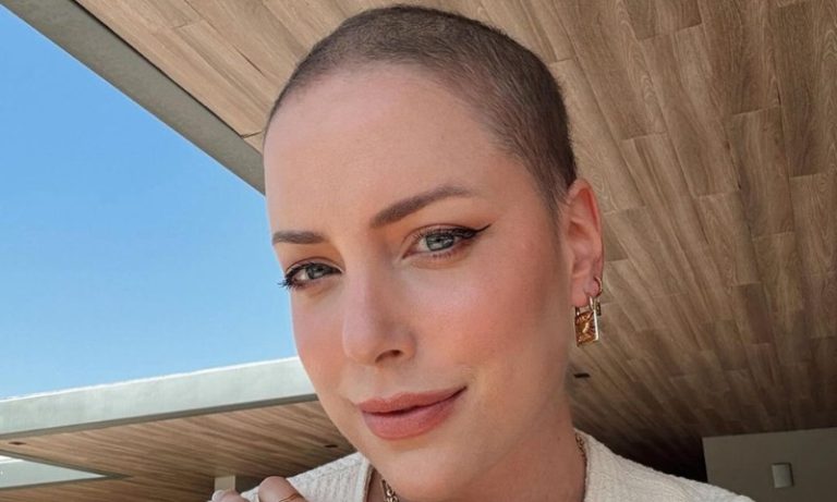 ‘Ressignificar’: Fabiana Justus celebra crescimento do cabelo após câncer