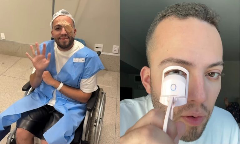 ‘Terçol permanente’ leva influencer a cirurgia após usar curvex; entenda infecção