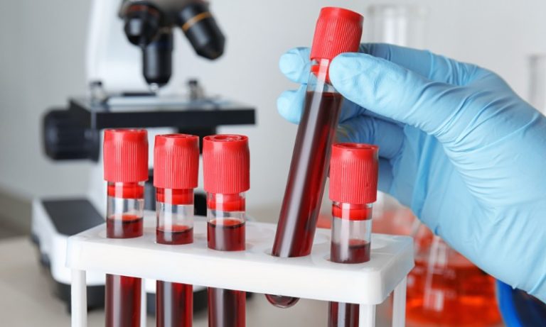 Erro humano causou infecção de pacientes por HIV após transplante, diz laboratório