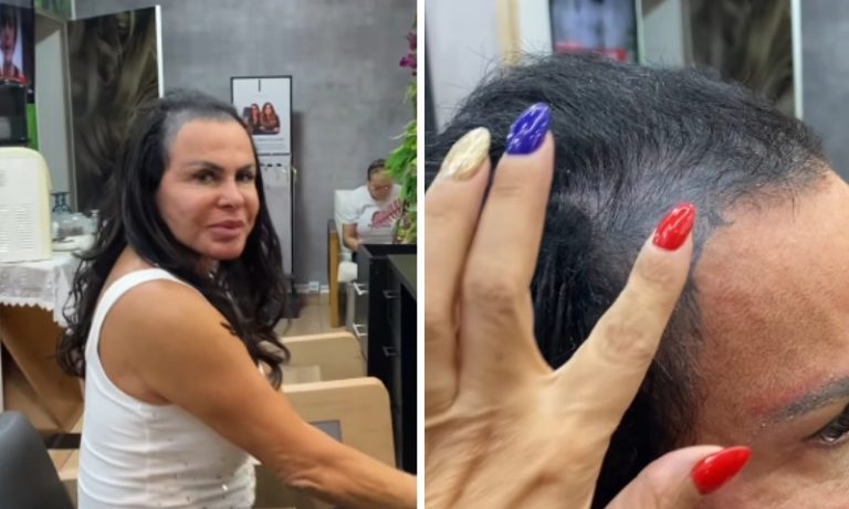 Gretchen surge sem prótese capilar e revela que ‘perdeu todo o cabelo’