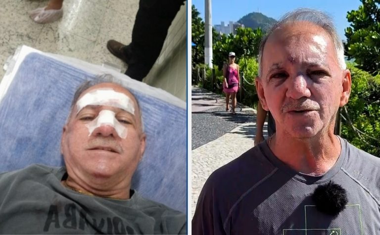 Homem é atropelado por patinete elétrico em ciclovia de Vila Velha