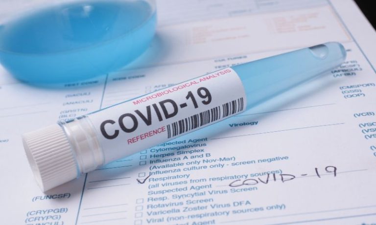 Primeiro óbito por Covid em Pernambuco em 2025: alerta para a vigilância sanitária
