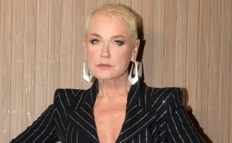 Xuxa fala sobre pouco cabelo e revela que tem alopecia androgenética