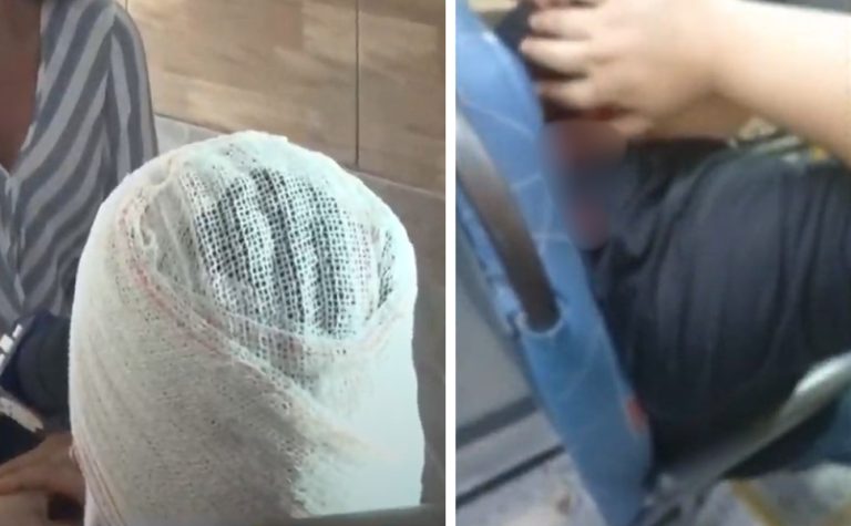 “Muita covardia”, diz passageira baleada na nuca durante assalto a ônibus na Serra