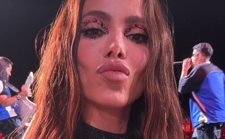 Anitta quer barrar uso de seu nome em remédio de vermes, diz colunista