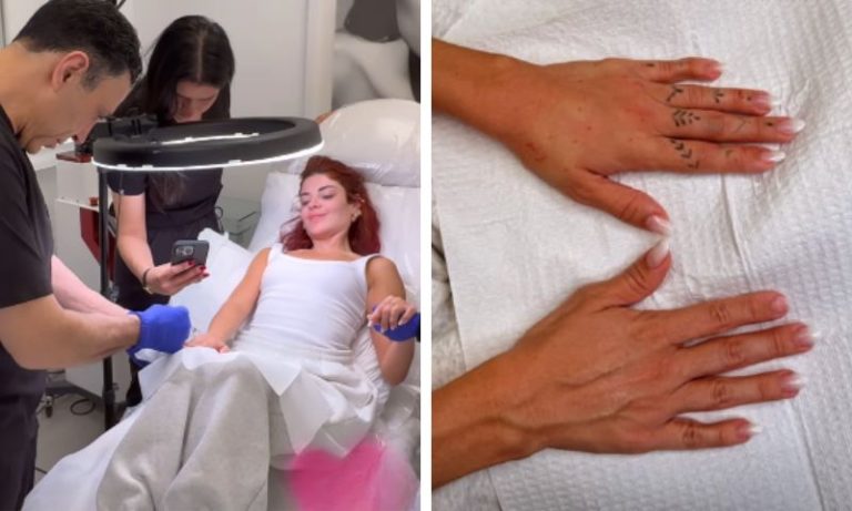 Gkay faz harmonização das mãos com médico das celebridades em Los Angeles