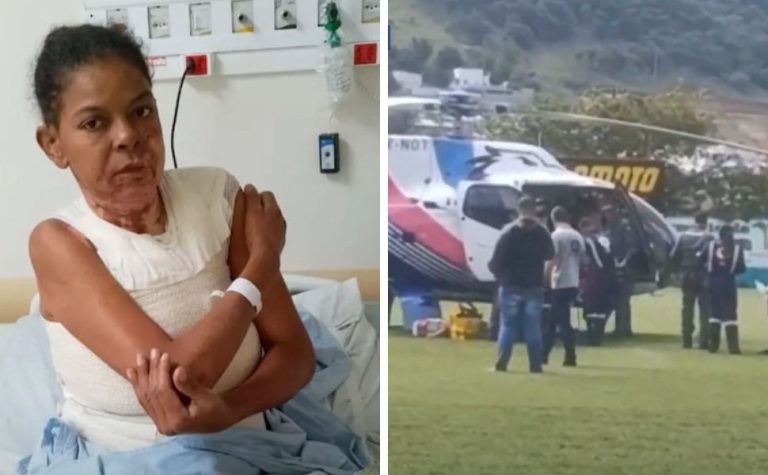 Mulher é internada na Serra após ter 15% do corpo queimado pelo companheiro