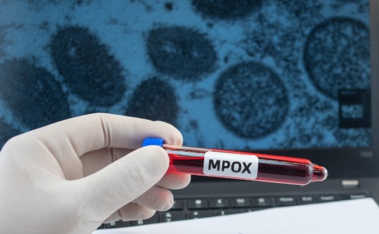 Região Norte do Brasil registra casos de mpox