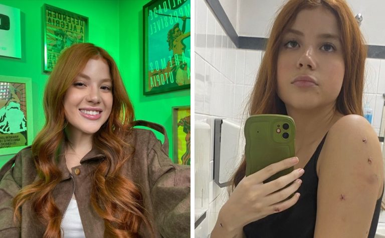 Influenciadora diz ter sido vítima de facadas dadas pelo irmão, preso em flagrante