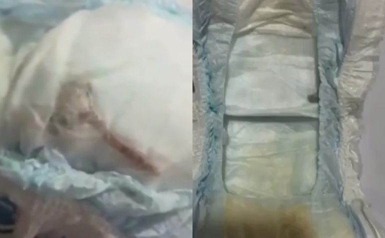 Mãe encontra rato morto dentro de fralda do filho; veja vídeo