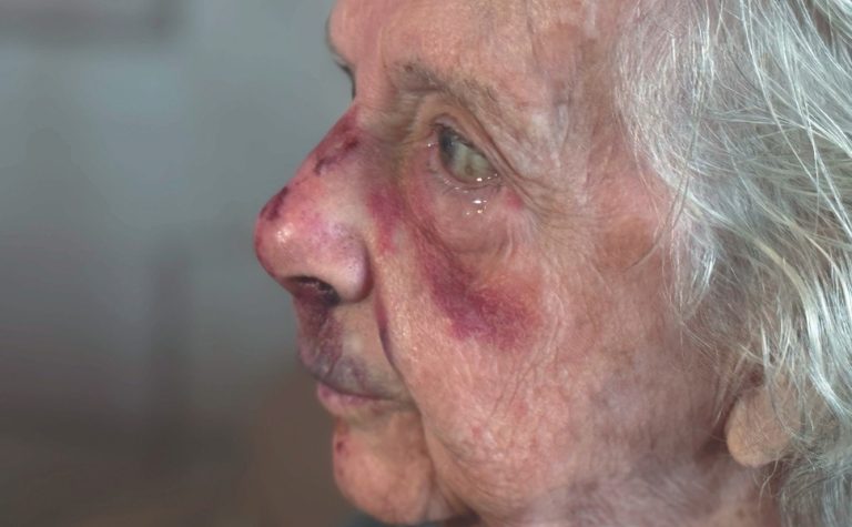 “Não vou deixar de sair”, diz idosa ferida em roubo no Centro de Vitória