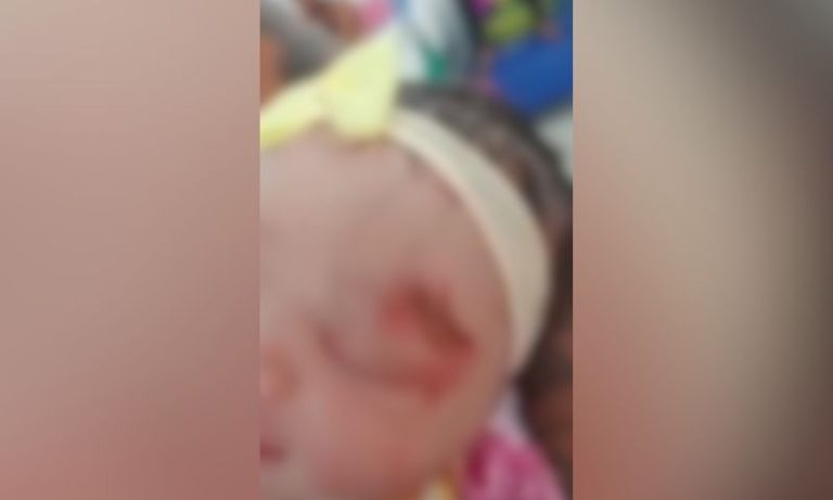 Negligência no parto: bebê nasce com ferimentos após atendimento no Tricentenário