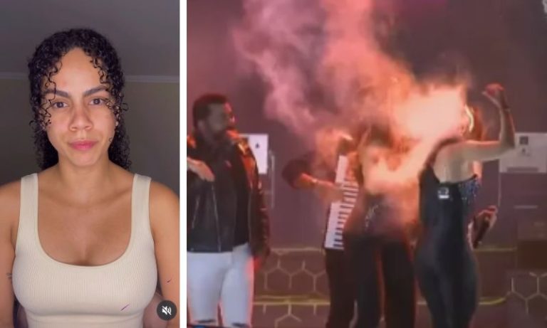 Após cabelo pegar fogo em show, Nath Souza se afasta com síndrome do pânico