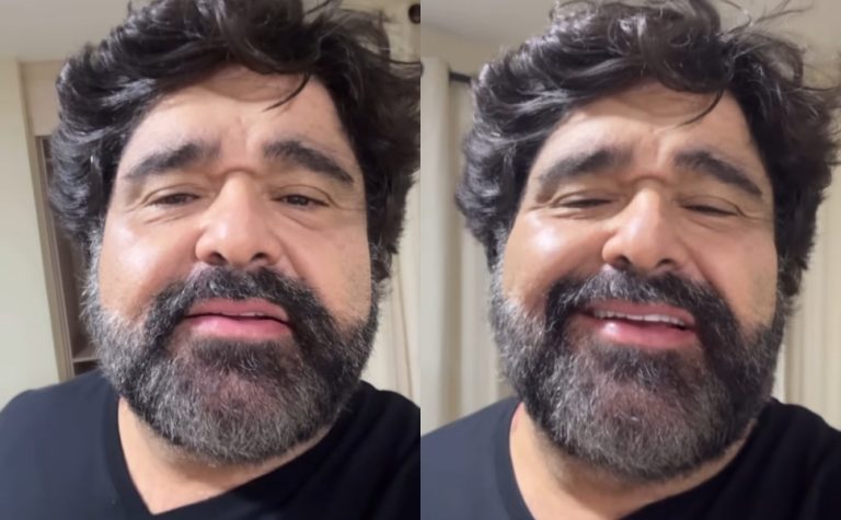Fabiano, da dupla com César Menotti, mantém show após sofrer acidente: ‘benção’