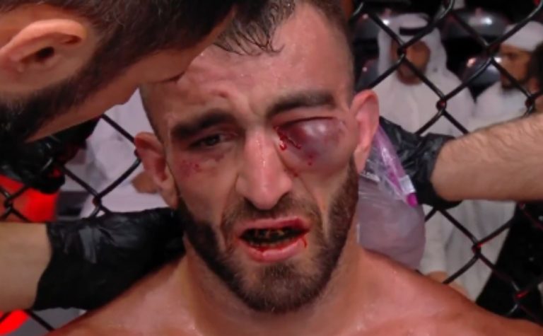 Lutador fica com olho inchado após pancadas e causa cena grotesca no UFC; veja