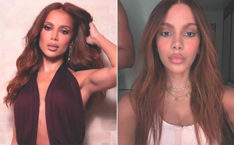 Novos procedimentos de Anitta priorizam naturalidade, dizem especialistas