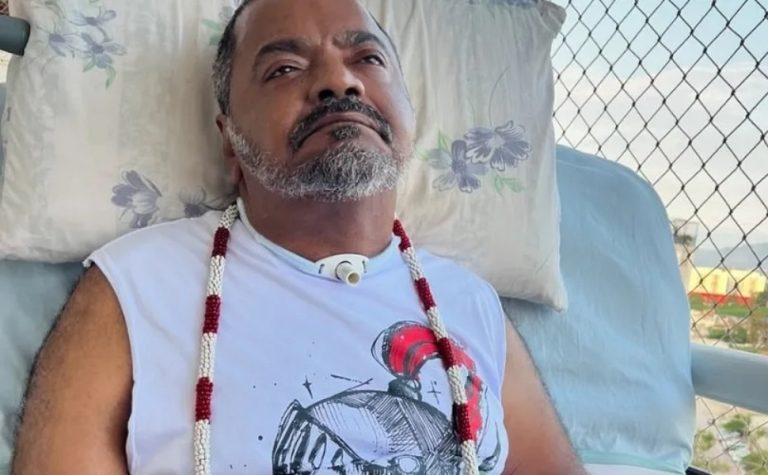 Arlindo Cruz, morto aos 66 anos, teve AVC hemorrágico; entenda a doença