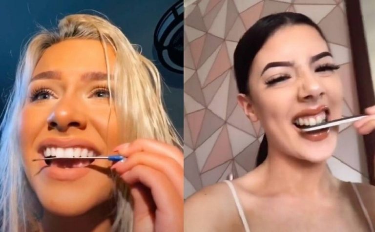 Especialistas alertam para moda perigosa que pode levar à perda de dentes