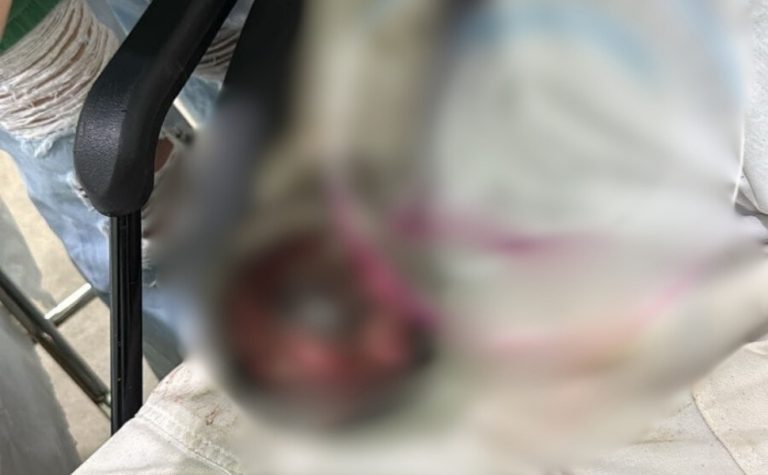 Açougueiro sofre acidente de trabalho e tem mão triturada por moedor em Colatina