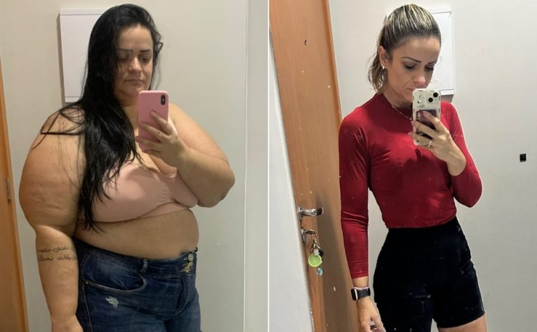 Da obesidade ao bem-estar: capixabas relatam mudanças de vida após a bariátrica
