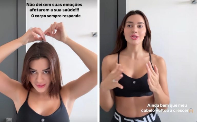 Franciny Ehlke revela que perdeu cabelo por estresse e fala sobre alopecia
