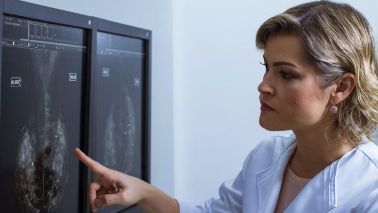 Pernambuco terá impacto com nova regra do SUS para mamografia a partir dos 40 anos