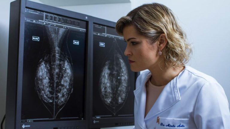 Uma em cada três mulheres com câncer de mama em PE tem menos de 50 anos