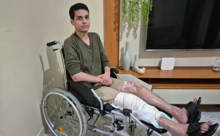 Vítima de acidente com moto: “Por causa da pressa perdi um ano e meio de minha vida