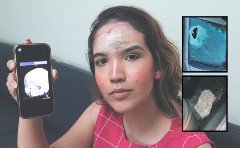Advogada que levou pedrada na Rodovia do Sol vai passar por nova cirurgia