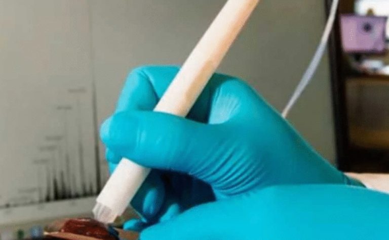 Caneta que detecta câncer durante cirurgia chega ao País