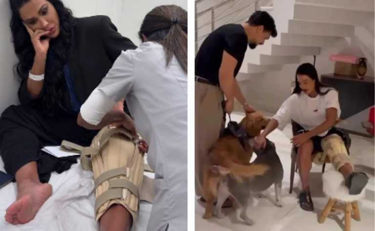 Gracyanne Barbosa compartilha detalhes de lesão no joelho após acidente