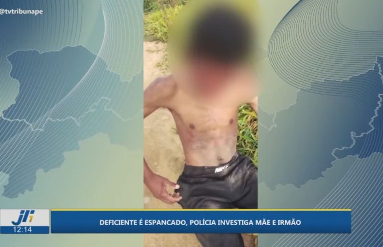 Jovem com deficiência é espancado e abandonado em terreno baldio em Garanhuns