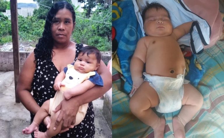 Secretaria de Saúde instaura auditoria para investigar parto de bebê de 7kg no ES