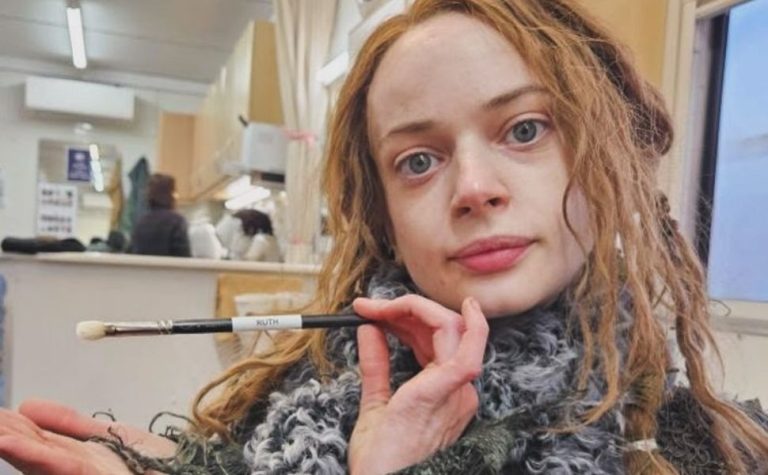 Aos 29 anos, atriz revela que amputou a 2ª perna: ‘boas e más notícias’