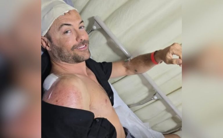 Após atropelamento grave em 2023, Kayky Brito se envolve em novo acidente