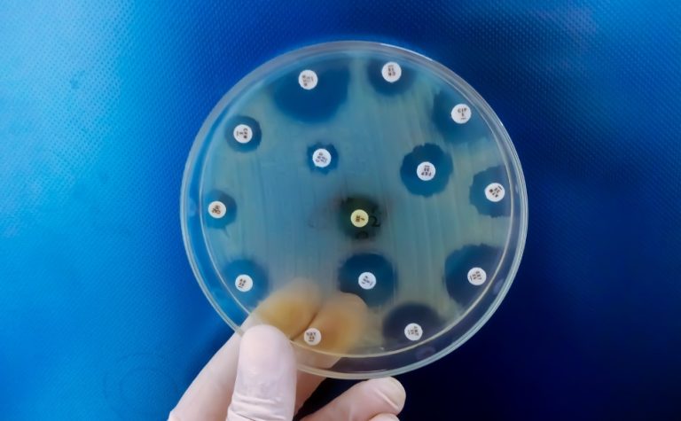 Após morte de menina, Praia Grande confirma 2º caso de meningite bacteriana
