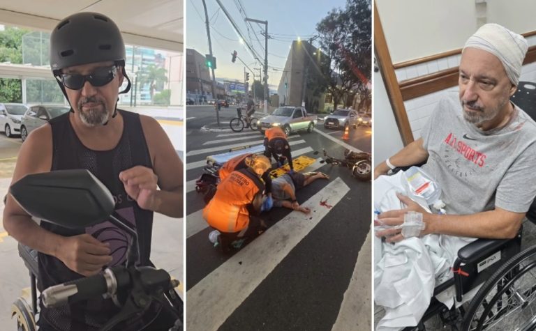 Chef de cozinha faz alerta após acidente com moto elétrica: “Usem capacete”