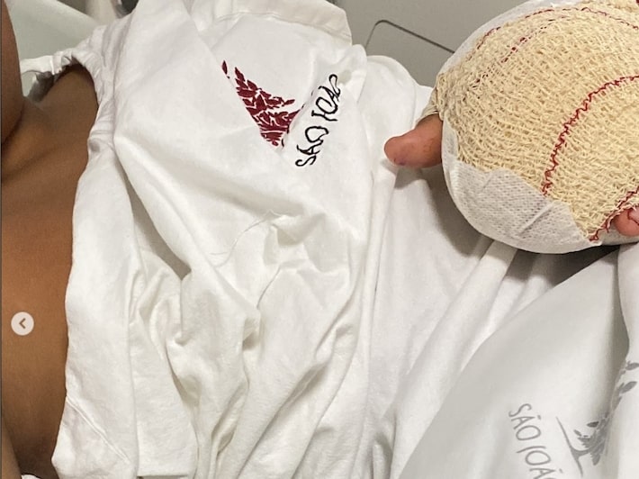 Governo de Portugal investiga caso de menino brasileiro que teve dedos mutilados