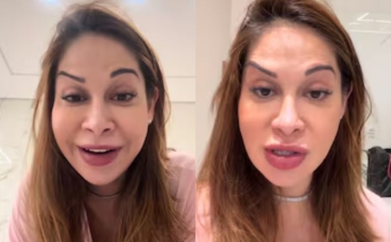 Maíra Cardi exibe rosto deformado após botox dar errado: ‘Olha que palhaçada’