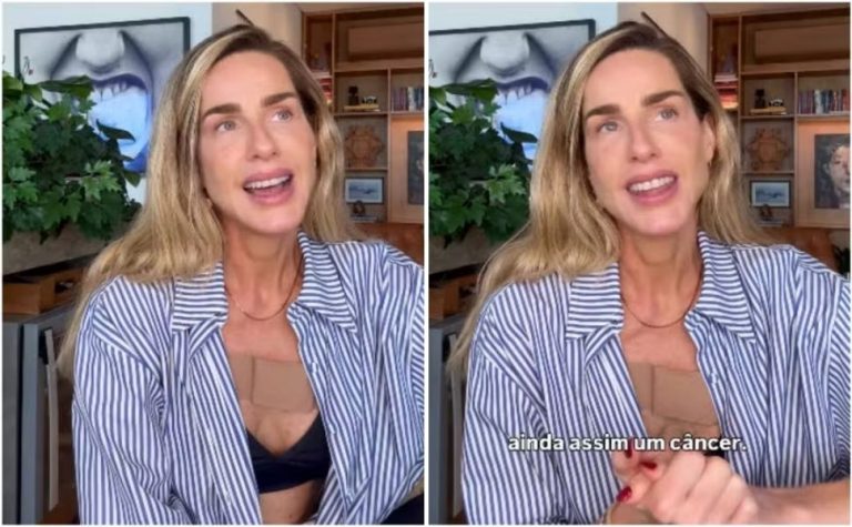 Mariana Weickert relata descoberta de câncer de pele