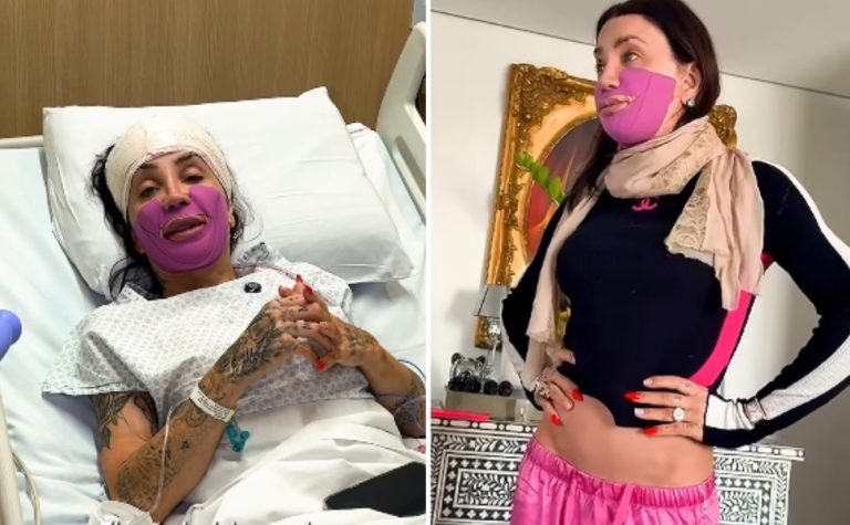 Maya Massafera exibe ossos que tirou do maxilar em nova cirurgia nas redes sociais