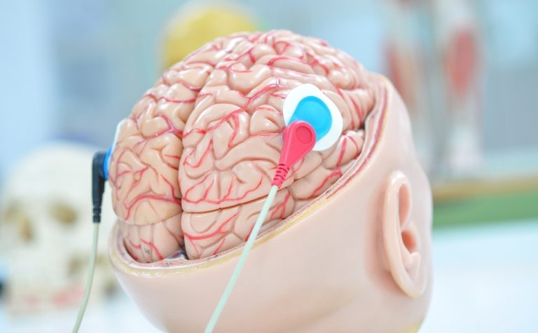 Unesco faz recomendação inédita para uso ético da neurotecnologia